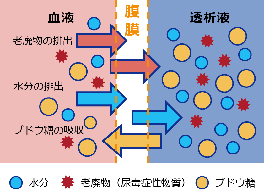 血液中の余分な水分や老廃物などが、腹膜を通して透析液側に移動する