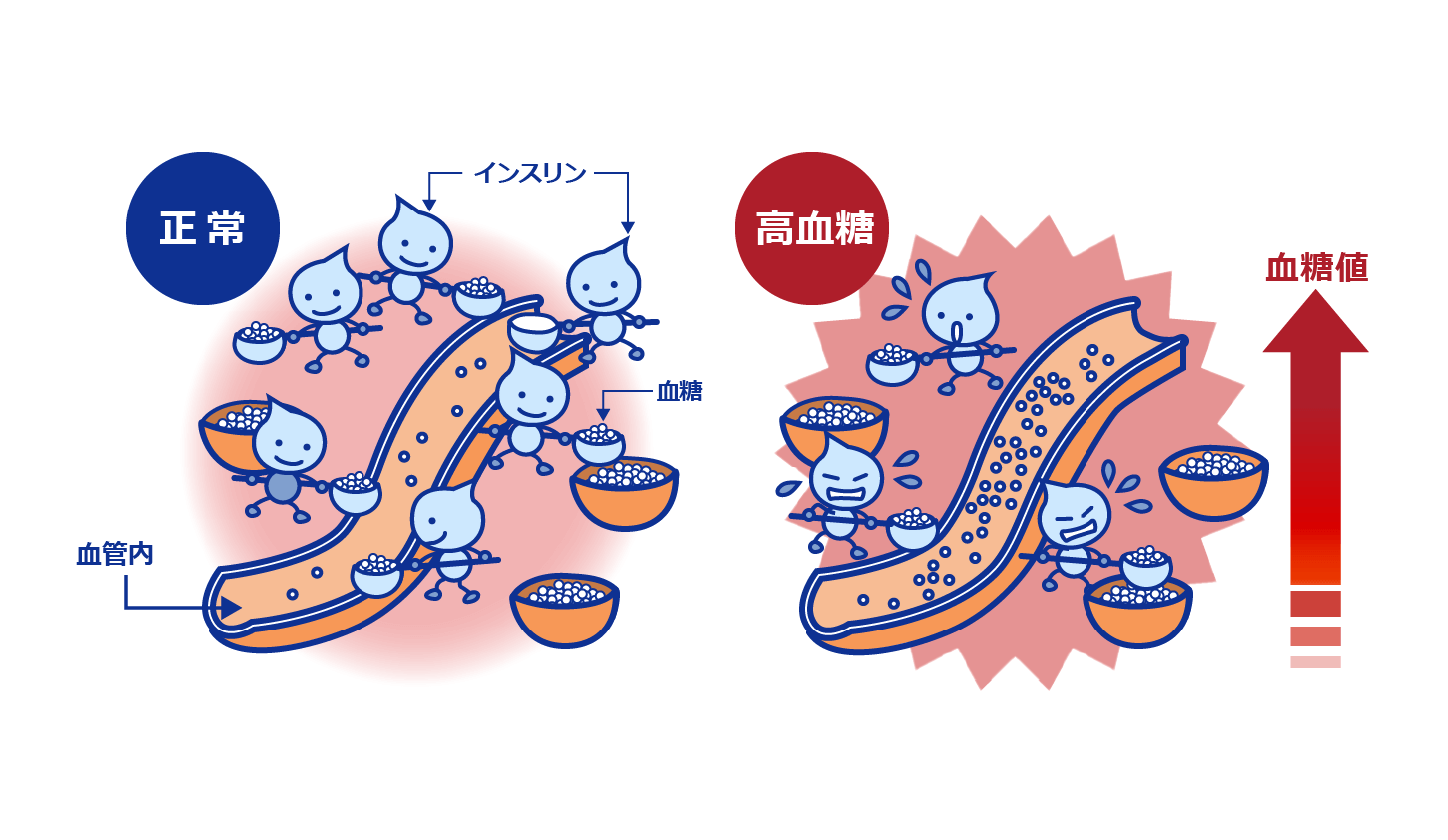 2型糖尿病について
