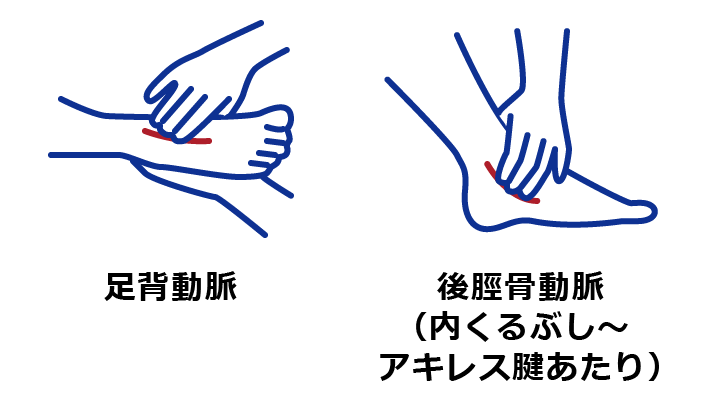 足背動脈や後脛骨動脈の拍動減弱