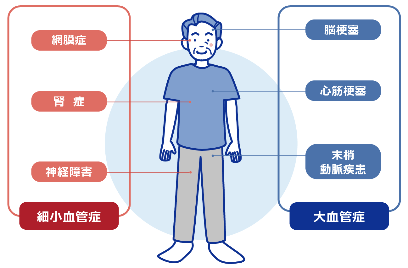 主な細小血管症と大血管症