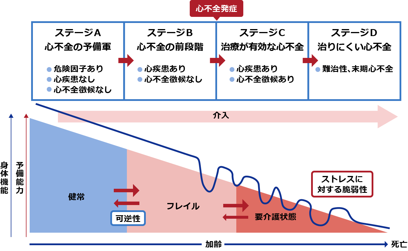 心不全の4つのステージ