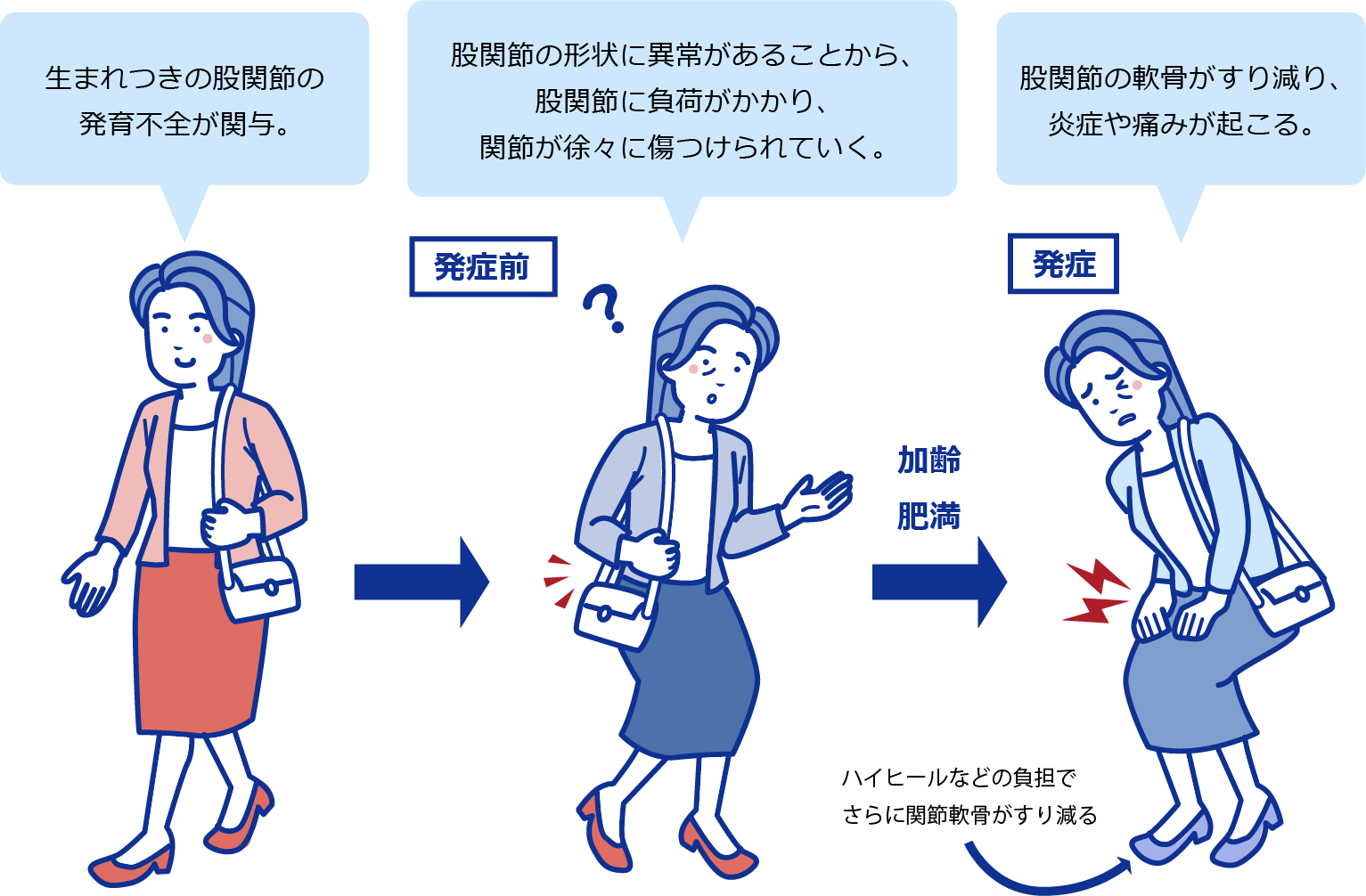 股関節の形状に異常があることから、関節が徐々に傷つけられていく