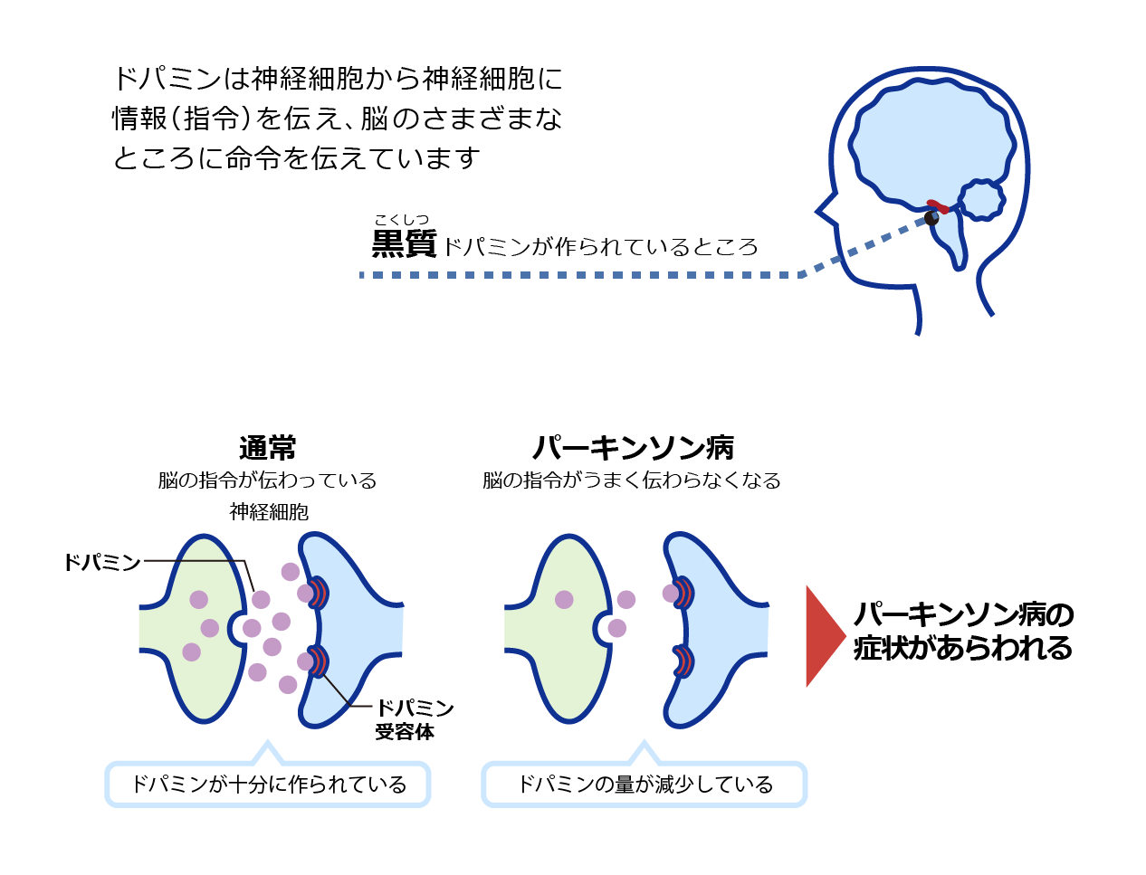 ドパミンとパーキンソン病